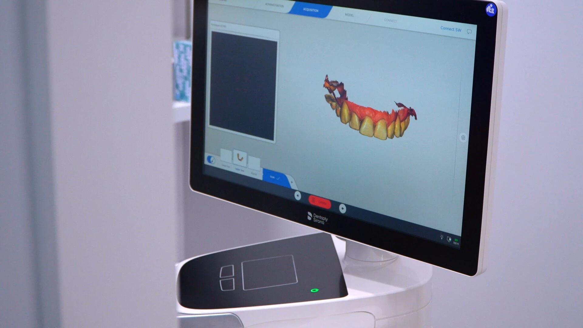 A high-definition monitor displaying a detailed 3D digital model of a patient's teeth using a Dentsply Sirona intraoral scanner in a dental clinic.