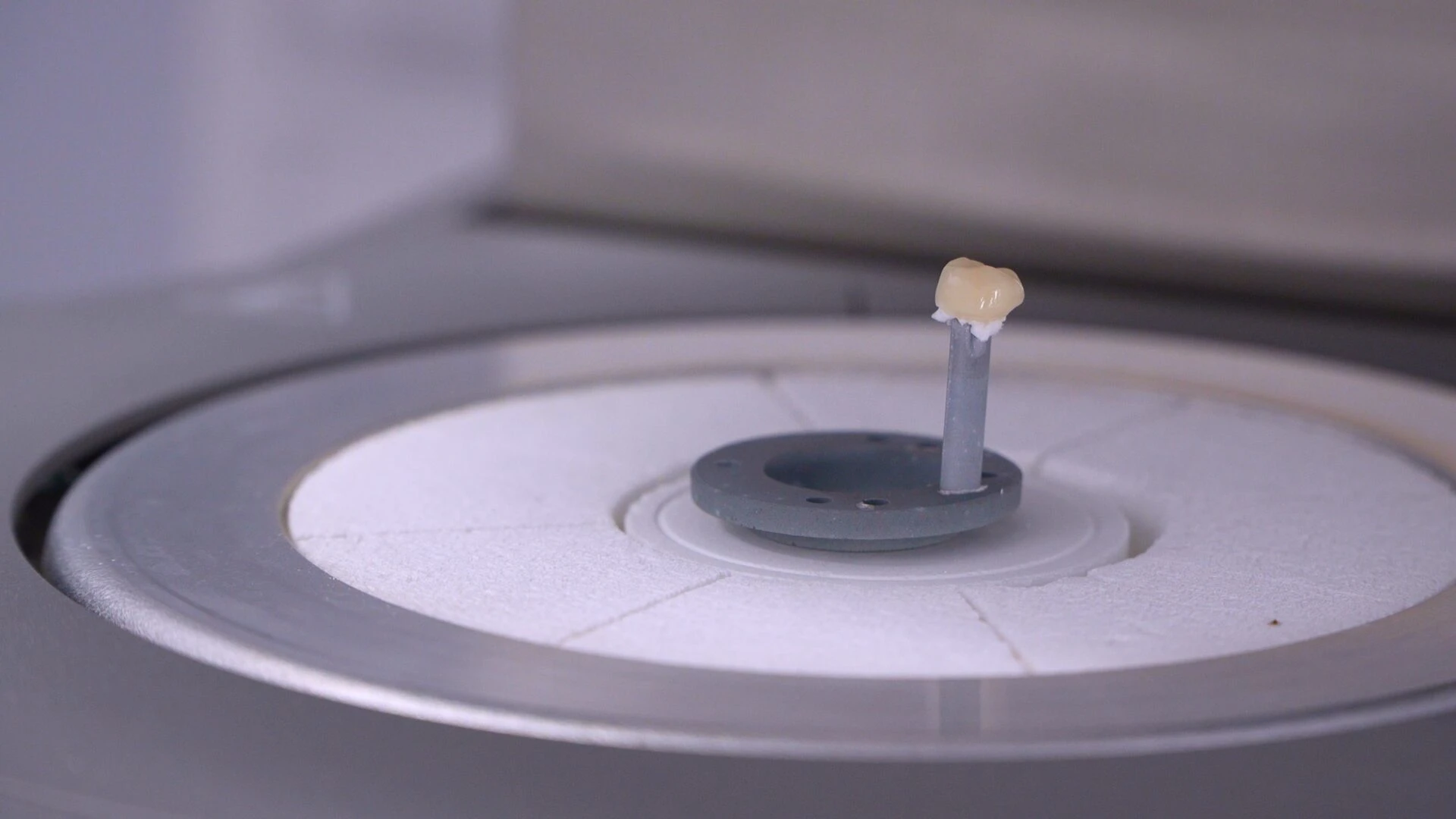 Close up of a patient's smile after porcelain veneer treatment at Pinecrest Family Dental