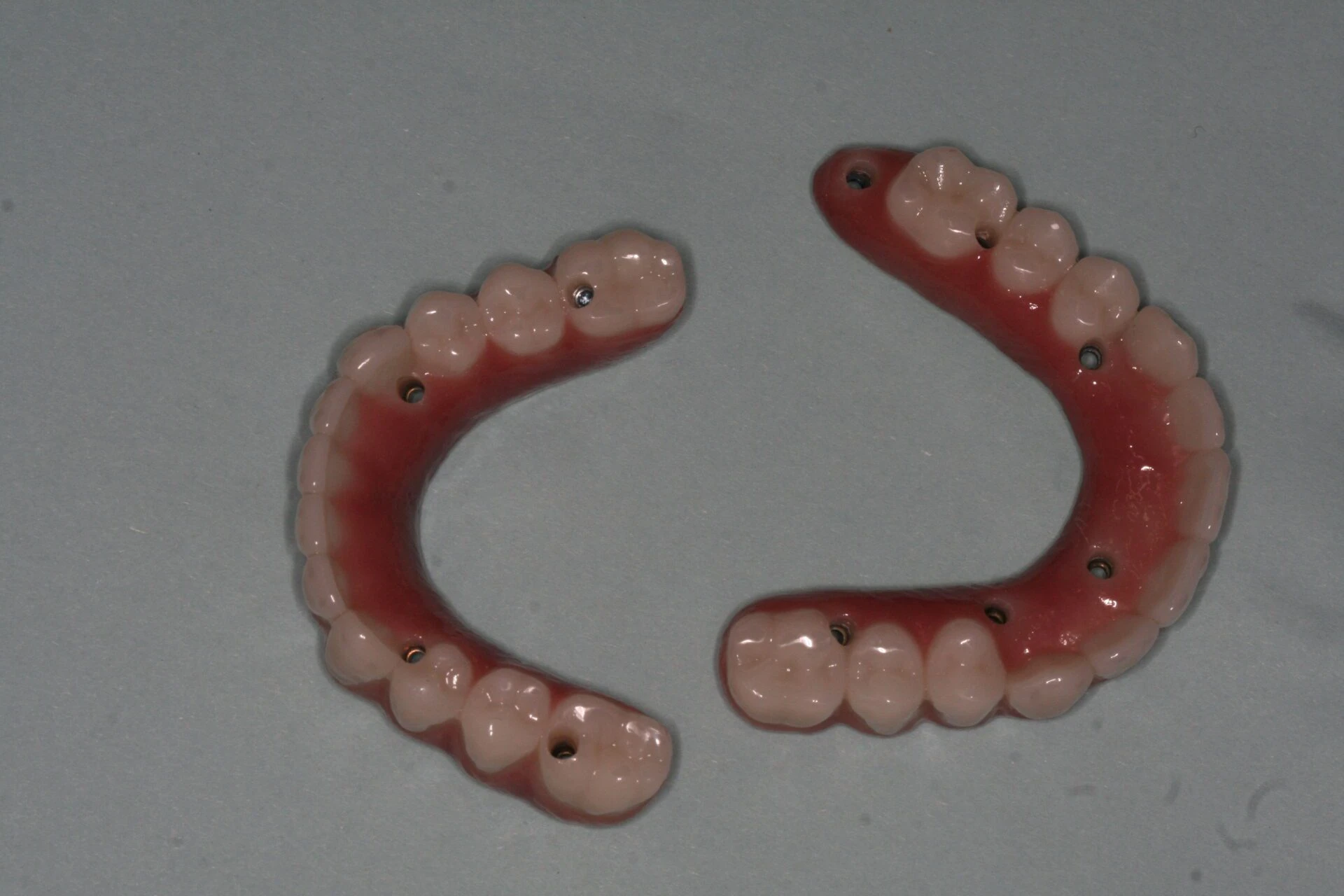 Oral Rehabilitation Case 3